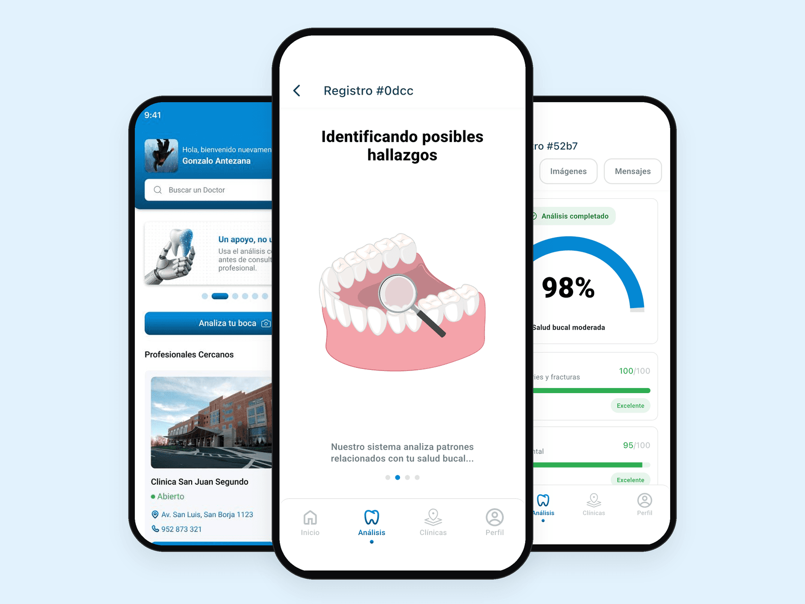 App Dexa Visión en tres pantallas